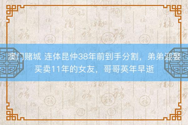 澳门赌城 连体昆仲38年前到手分割，弟弟迎娶买卖11年的女友，哥哥英年早逝